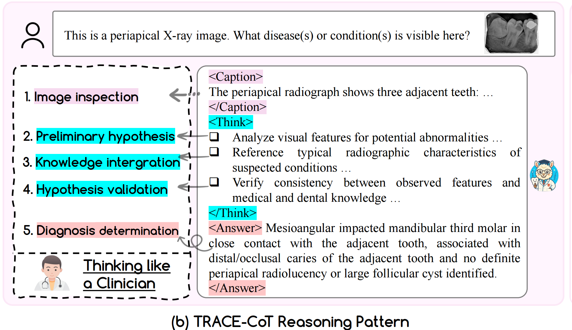 新研究：港大牵头多校发布牙科多模态大语言模型，基准测试超GPT-5三倍- 好的牙